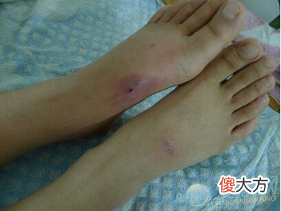 梦见蛇咬脚是什么预兆，梦见蛇咬脚是什么预兆